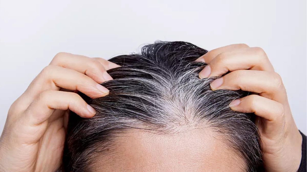 Common mistakes which cause premature greying of hair